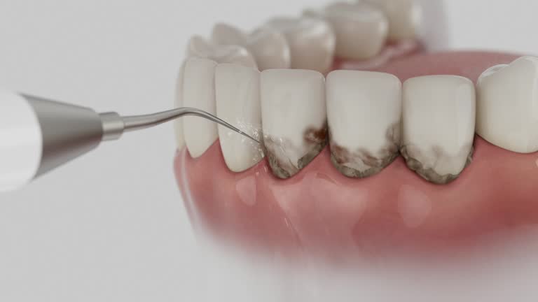 Reliable Dental Implants contractor in Newark, CA by Smile Center Dentistry